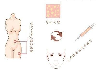 南通鼻整形實力強勁醫(yī)院盤點：專業(yè)醫(yī)師，打造精致鼻型