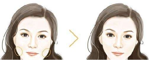 佛山生命加整形美容價格大揭秘，張春光元氣美狐眼等你了解