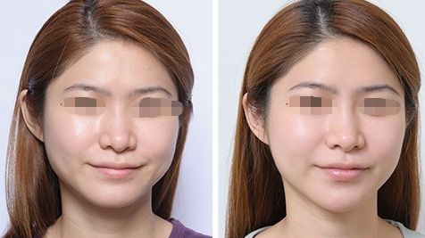 2024成都璞齡醫(yī)療美容價(jià)格與專(zhuān)家門(mén)診服務(wù)一覽