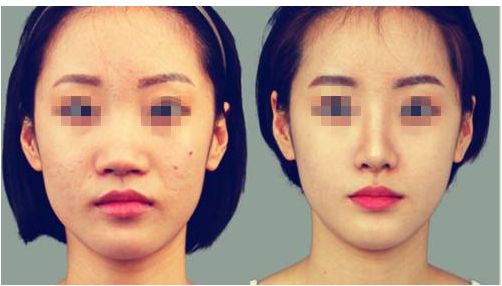 泉州哪些醫(yī)院擅長整形手術？