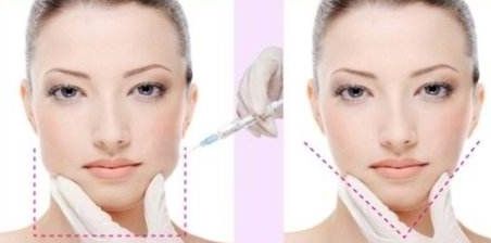 2024年成都哪家正畸醫(yī)院口碑好？價格查詢澤西醫(yī)生正畸美團優(yōu)惠