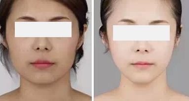 衢州雙眼皮整形醫(yī)院排行榜前八名匯總