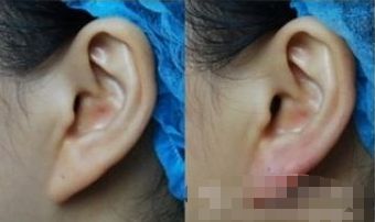 湖州哪家醫(yī)院能有效提升面部外觀？