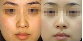 岳陽最佳整形醫(yī)院排行榜