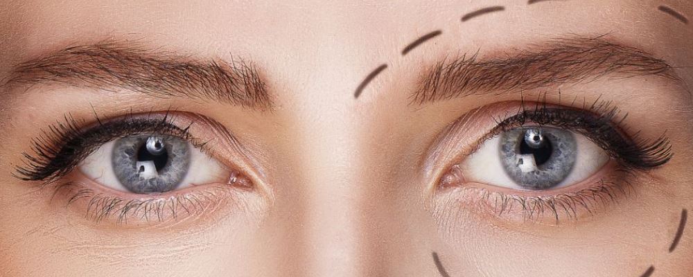 眼皮青紫，5款有效改善方法大揭秘