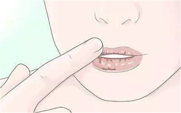 南寧光子嫩膚治療黑頭醫(yī)生