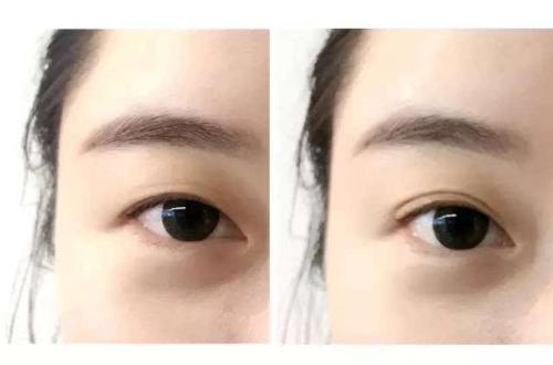 揚州自體干細(xì)胞除皺醫(yī)生