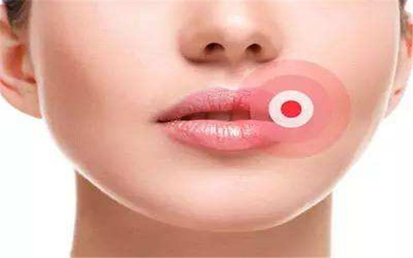 廣西鼻部失敗修復(fù)醫(yī)生