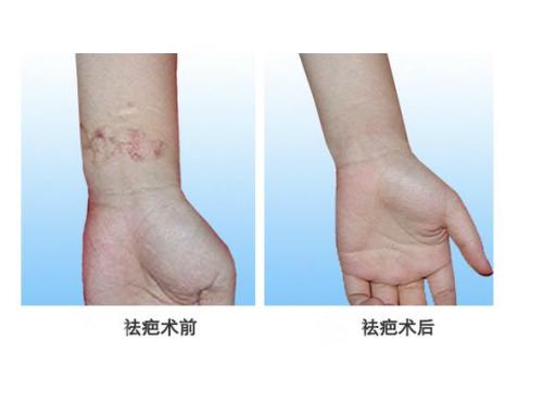 濟(jì)南重瞼醫(yī)生