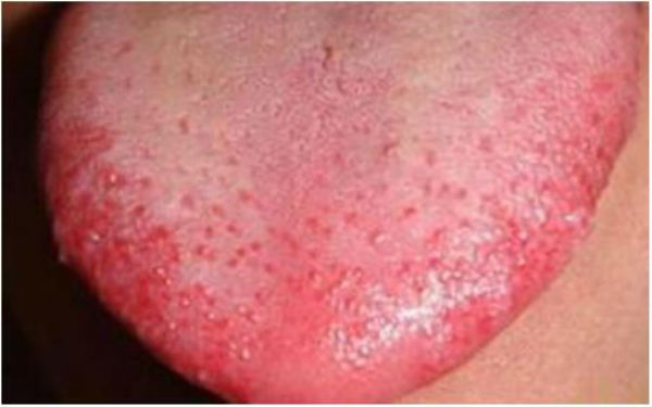 貴陽360度私密環(huán)形緊縮術(shù)醫(yī)生