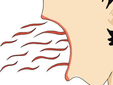 遵義手術(shù)切除眉間紋醫(yī)生