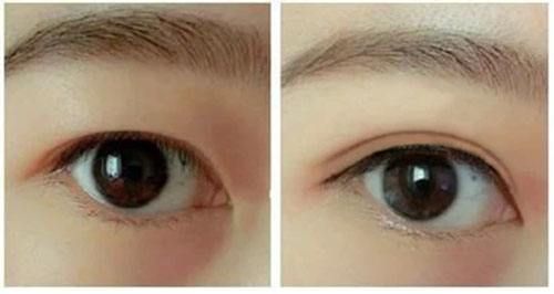 秦皇島深藍射頻面部醫(yī)生