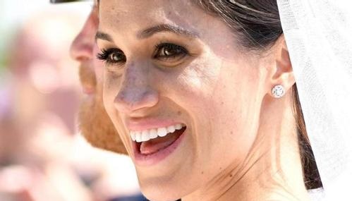 鄭州玻尿酸打唇紋醫(yī)生