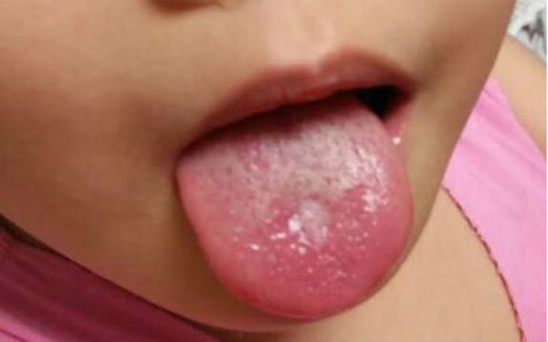 山東點(diǎn)陣激光治療皮膚醫(yī)生