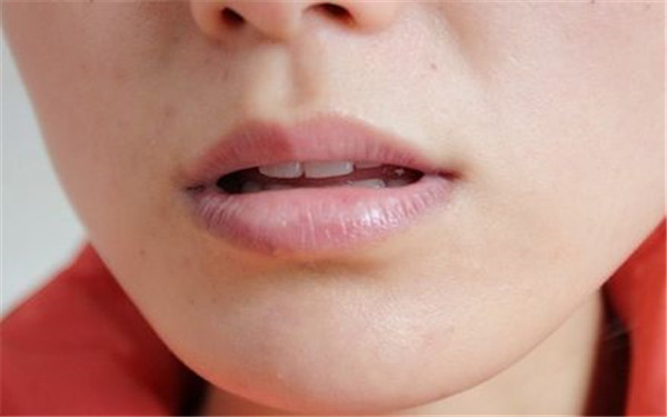 中山超微創(chuàng)眉間紋醫(yī)生