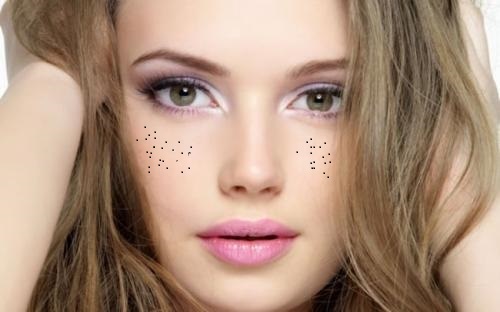 承德副乳吸脂醫(yī)生