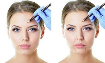 海口收縮鼻翼醫(yī)生