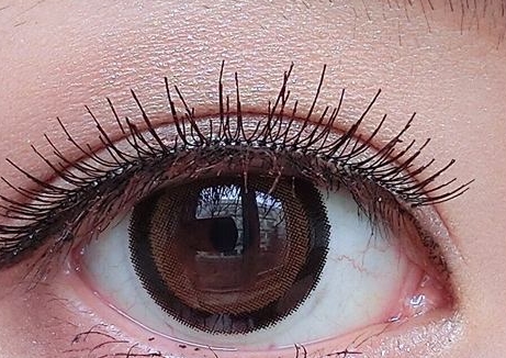 珠海上瞼皺紋醫(yī)生