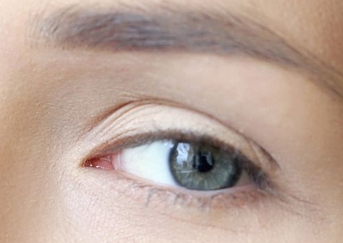 南京小切口拉皮除皺術(shù)醫(yī)生