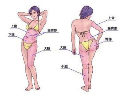 武漢光纖溶脂祛動(dòng)態(tài)細(xì)紋醫(yī)生