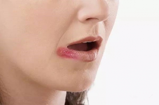 湘潭皮膚除斑醫(yī)生