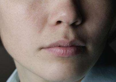 北京嗨體額頭注射醫(yī)生