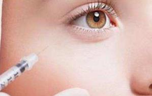 肇慶光電去除生長(zhǎng)紋醫(yī)生