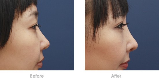 四川痘印點(diǎn)陣激光醫(yī)生