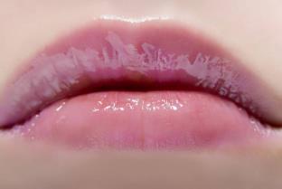 上海光子嫩膚去黑眼圈醫(yī)生