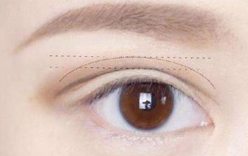 深圳法國sk水光針醫(yī)生