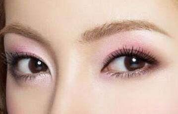 東莞額頭靜態(tài)皺紋手術醫(yī)生