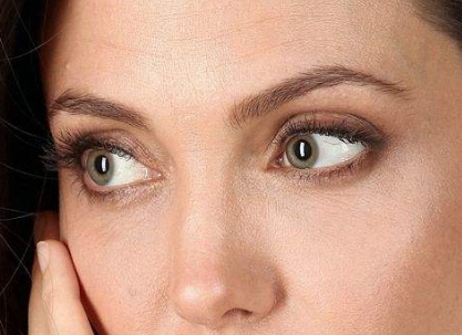 上海韓國除皺復(fù)顏術(shù)醫(yī)生