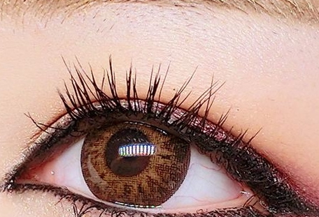 青?；瘜W(xué)剝脫祛鮮紅斑痣醫(yī)生