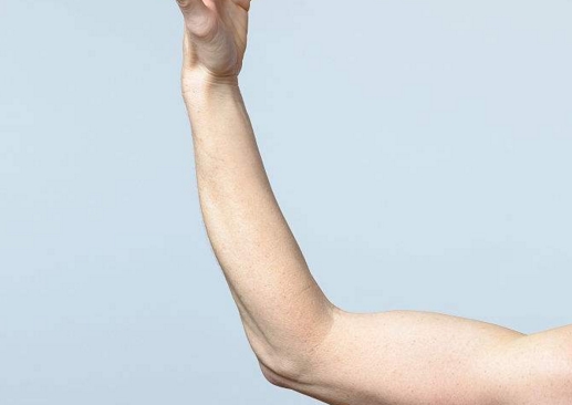 深圳細胞激活眼周紋醫(yī)生