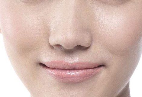 湖南玻尿酸去動態(tài)紋醫(yī)生