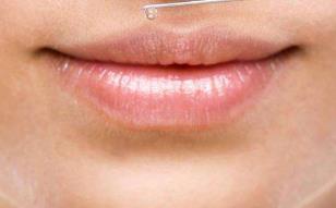 長沙隆下巴整形整形醫(yī)生