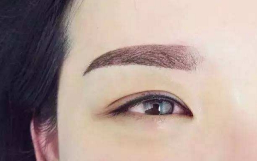 惠州靜態(tài)紋微針填充醫(yī)生