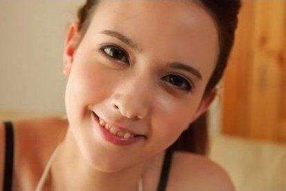 長(zhǎng)沙去深皺紋醫(yī)生