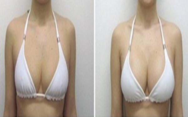 臨沂假體鼻子醫(yī)生