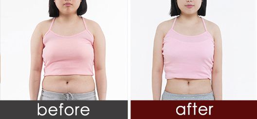 汕頭眼角提拉術醫(yī)生