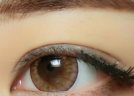 信陽玻尿酸去眼底紋醫(yī)生