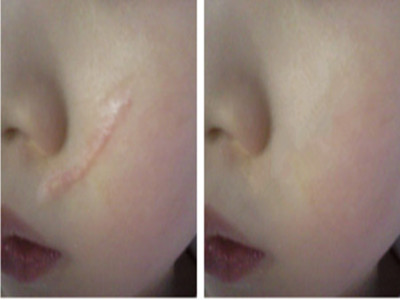 鄭州隆鼻線雕醫(yī)生