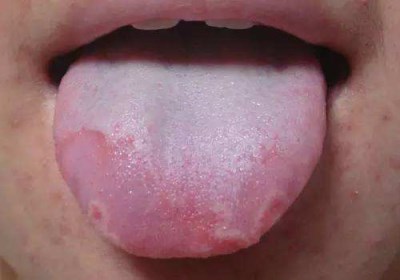 寧波耳再造耳修復(fù)醫(yī)生