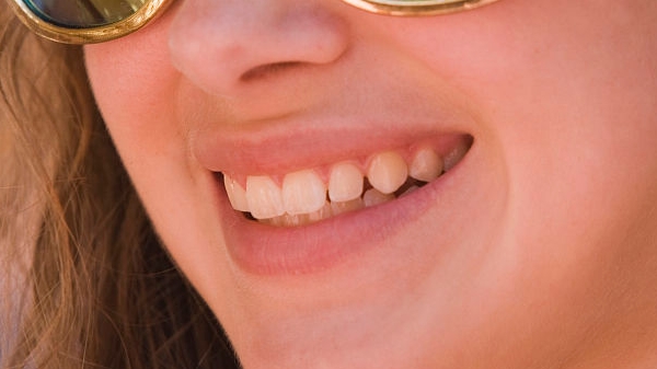 陜西微創(chuàng)妊娠紋醫(yī)生