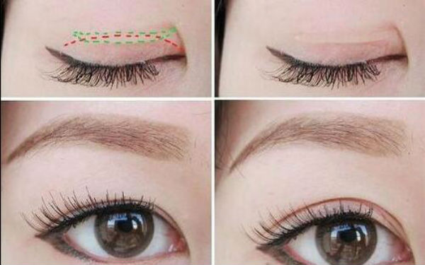 2023年臨沂市治療色斑好的醫(yī)療機(jī)構(gòu)比較，一個(gè)新的醫(yī)院排名榜發(fā)布！公立、私立醫(yī)院對(duì)比分析結(jié)果-最新報(bào)價(jià)一