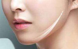 北京假體墊鼻基底醫(yī)生