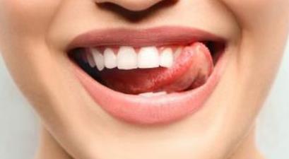 武漢干細胞填充魚尾紋醫(yī)生