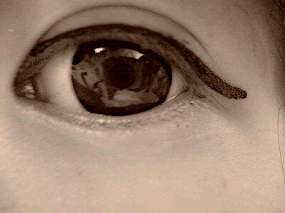 南京膠原蛋白填充眼周醫(yī)生