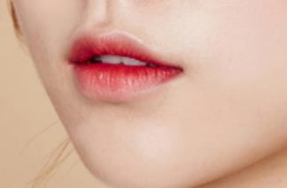 沈陽鼻翼缺損整形醫(yī)生