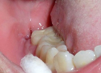 2023南寧地區(qū)五家頂尖牙科醫(yī)院排名揭曉，備受贊譽！